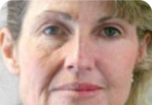 PRP Ultra centrifuge for low volume autologous